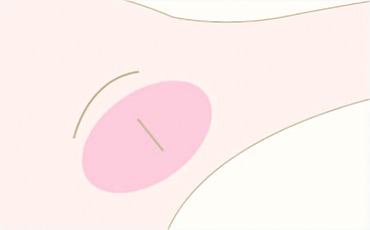 STEP.1