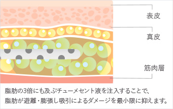 術後のダメージを最小限に抑える工夫