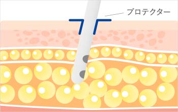 傷跡残さない