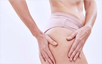 脂肪吸引後の修正手術とは