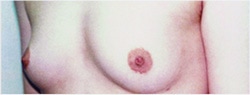 授乳により小さくなってしまった