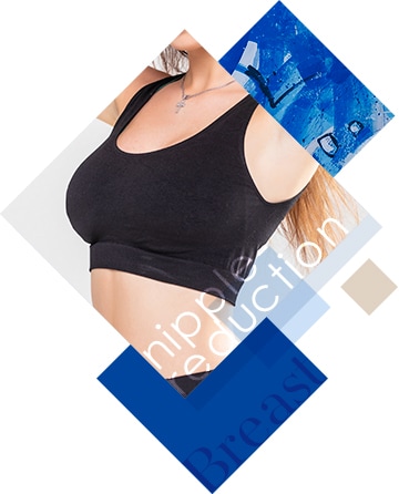 乳頭（乳首）縮小術