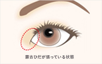 施術方法