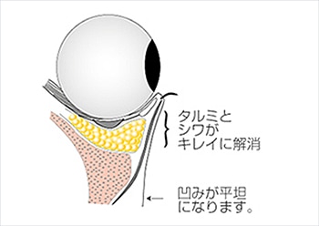 「眼窩」という窪みに収まって