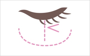 経皮法