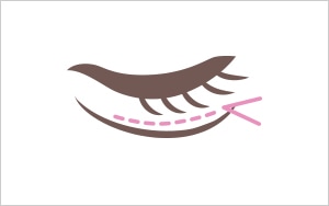 経結膜法