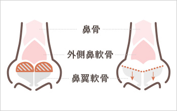 手順
