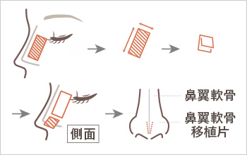 手順