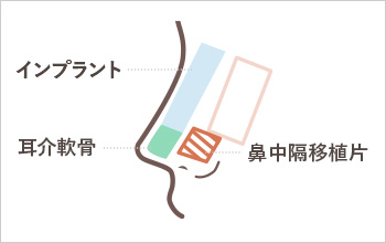 手順