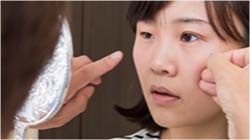 目立たない箇所から移植毛を採取