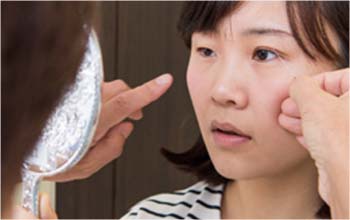 上眼瞼切開をご提案