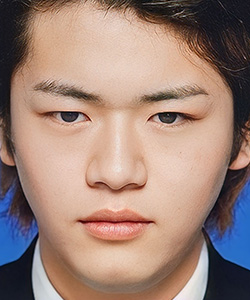 目頭切開 施術前