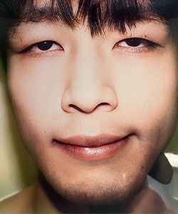 マイクロカット法 施術前